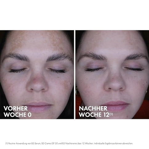 Vichy Lift Activ Anti-Pigmentflecken Tagescreme SPF50 50 ml