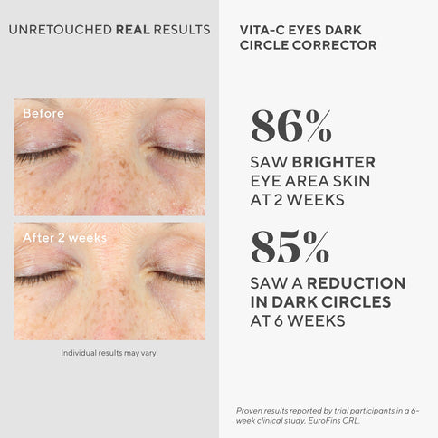 Murad Vita-C Eyes Dark Circle Corrector 15 ml